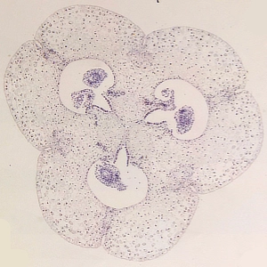 Lily Ovary Crosscut